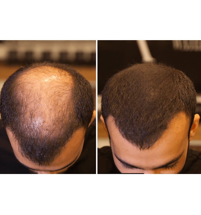 Fixdeep Topical Shader & Root Cover Up / Açık Kahve