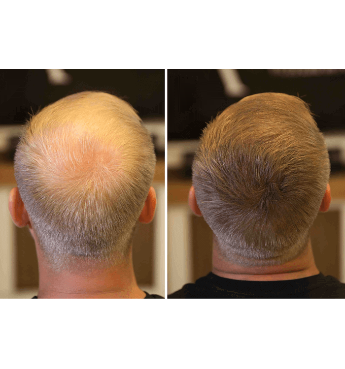 Fixplant 3 Set 84 Gram